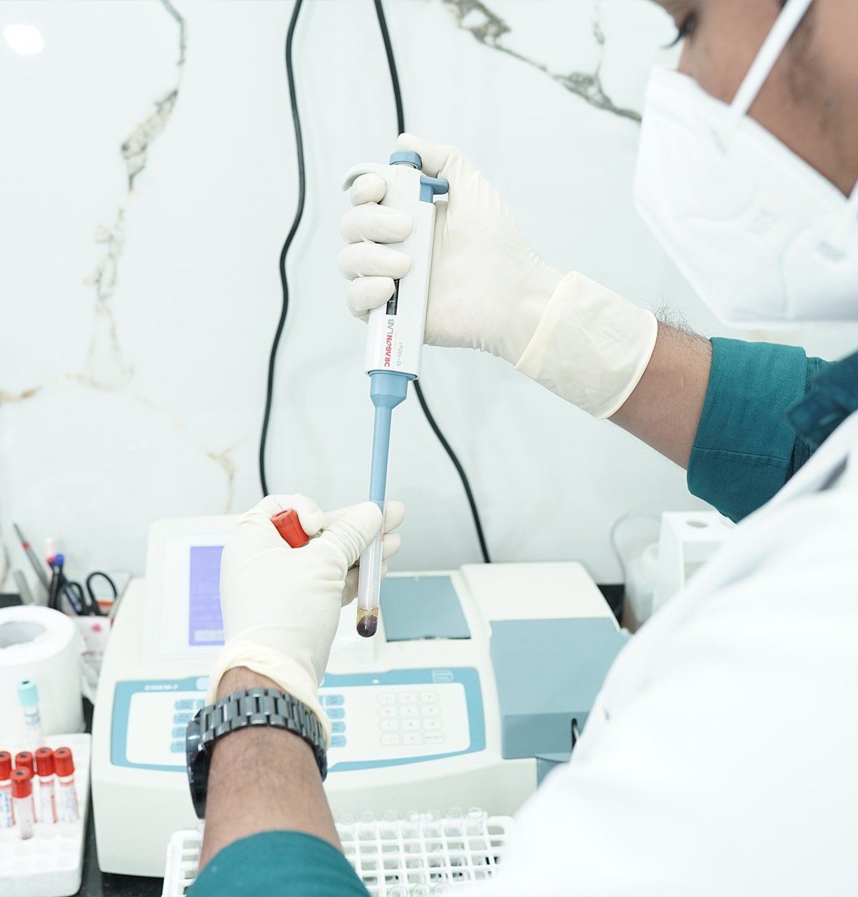 Lab technician handling a blood sample with a micropipette in a nursing home diagnostic lab.